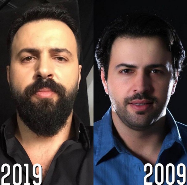 Celebrities' 10 Year Challenge goes viral!