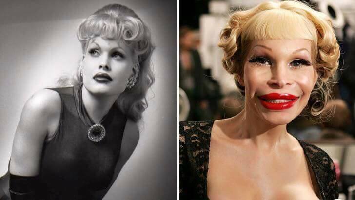 Celebrity plastic surgery before and after