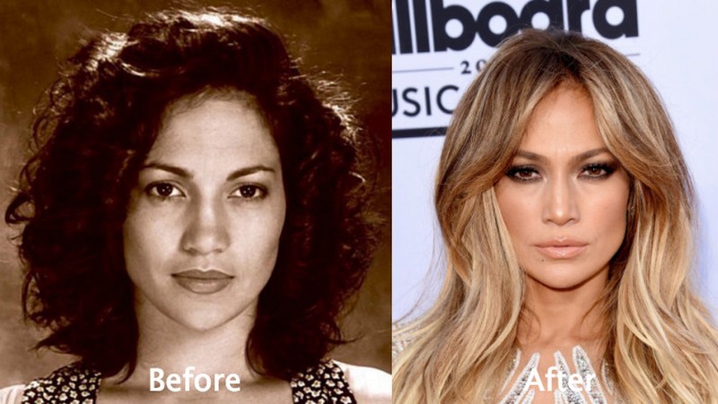 Hollywood Celebrities Before After