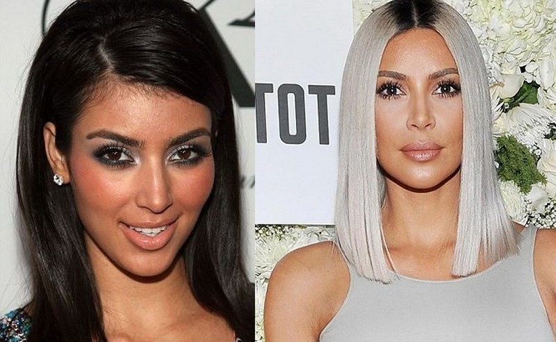 Hollywood Celebrities Before After