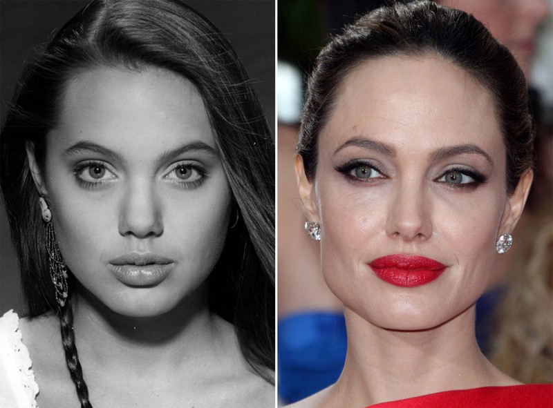 Hollywood Celebrities Before After