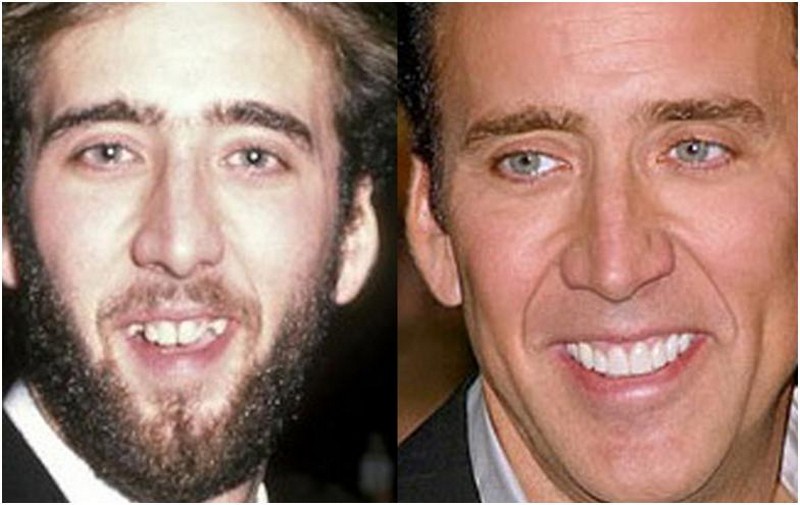 Hollywood Celebrities Before After