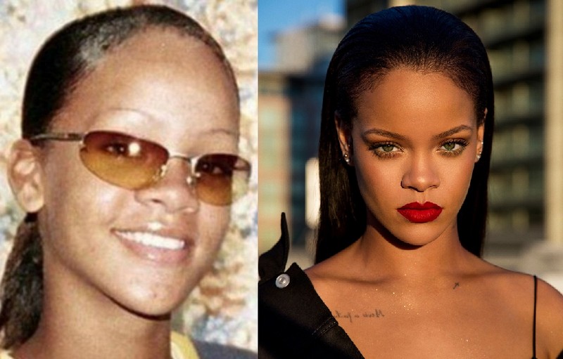 Hollywood Celebrities Before After