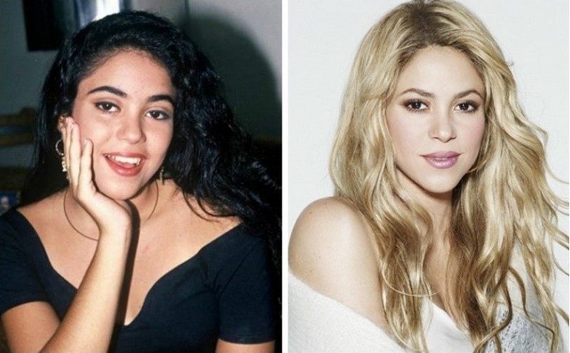 Hollywood Celebrities Before After