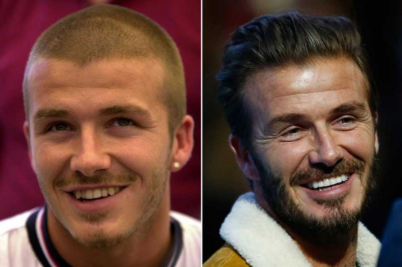 Hollywood Celebrities Before After