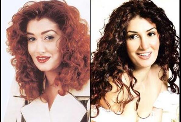 Arab Celebrities Before After