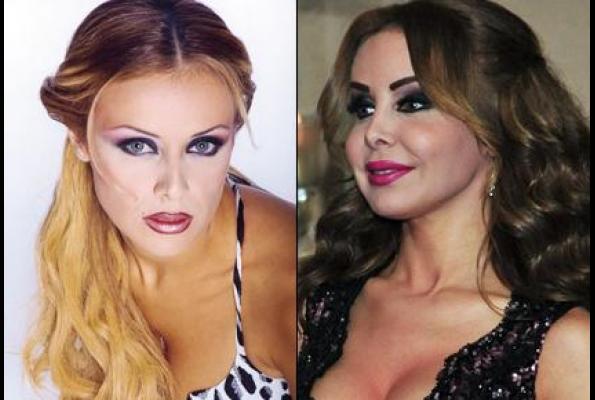 Arab Celebrities Before After