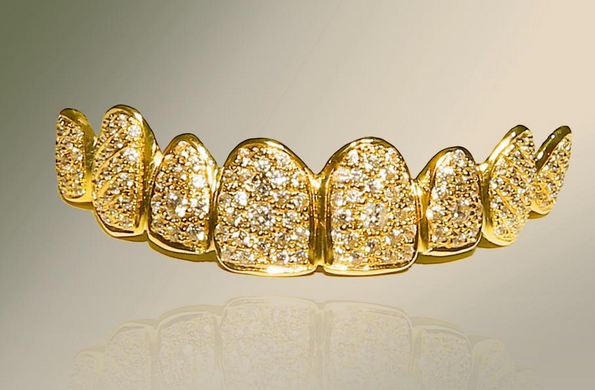 Dentist In Dubai Creates Diamond-Encrusted Dentures Worth $153K 