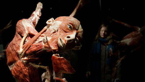 Obssessed with Death: German Anatomist Dubbed Doctor Death Opens a Corpse Museum