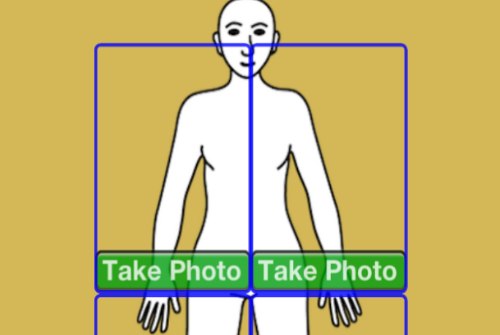 An iPhone App for Skin Cancer Diagnosis