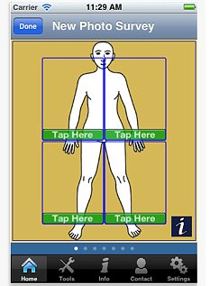 An iPhone App for Skin Cancer Diagnosis
