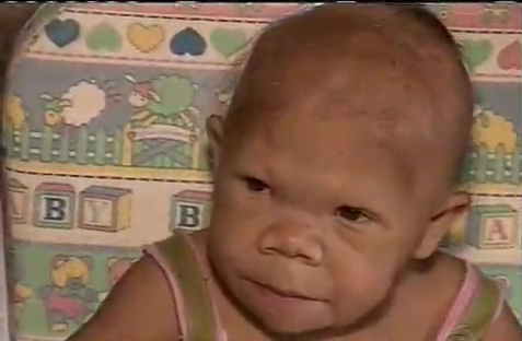 Brazilian woman never outgrew 9 months