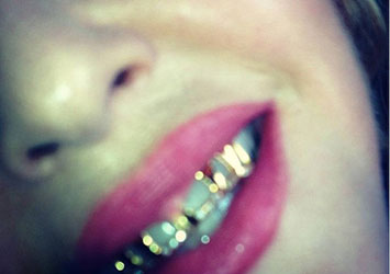 Celebrity Spotted With Gold Teeth Caps 