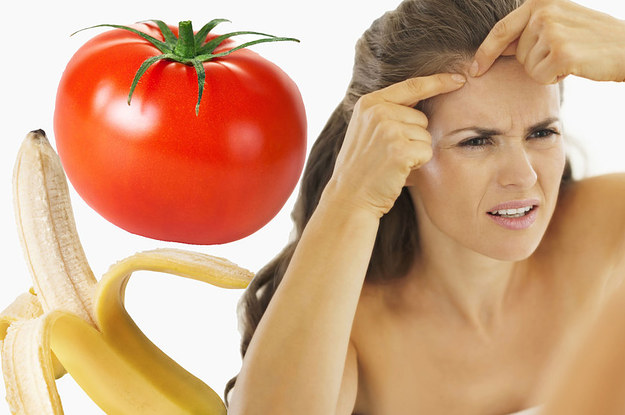 18 Pimple Hacks You Need To Try