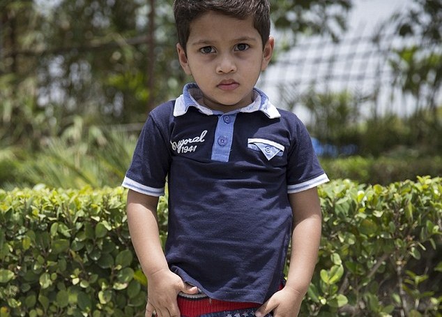 One-year-old Indian infant develops fully grown sexual organs