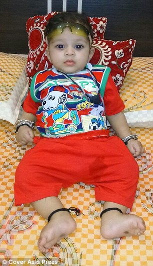 One-year-old Indian infant develops fully grown sexual organs