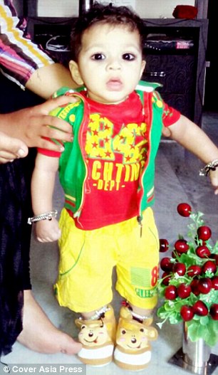 One-year-old Indian infant develops fully grown sexual organs