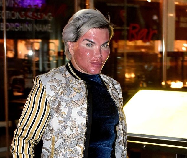 Human Ken Doll Rodrigo Alves: My face is burning
