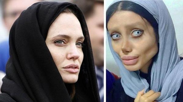 Iranian Woman Went Through 50 Surgeries To Look Like Angelina Jolie