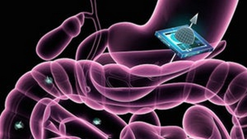 Doctors Will See Through Your Body Using an Ingestible Chip!
