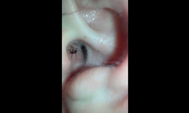 A man feels something scratching in his ear and finds THIS