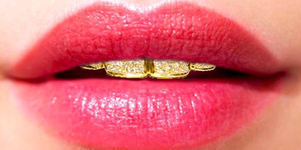 Dentist In Dubai Creates Diamond-Encrusted Dentures Worth $153K 