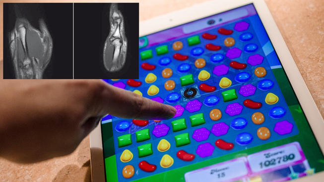 Candy Crush Saga Puts Man In Hospital
