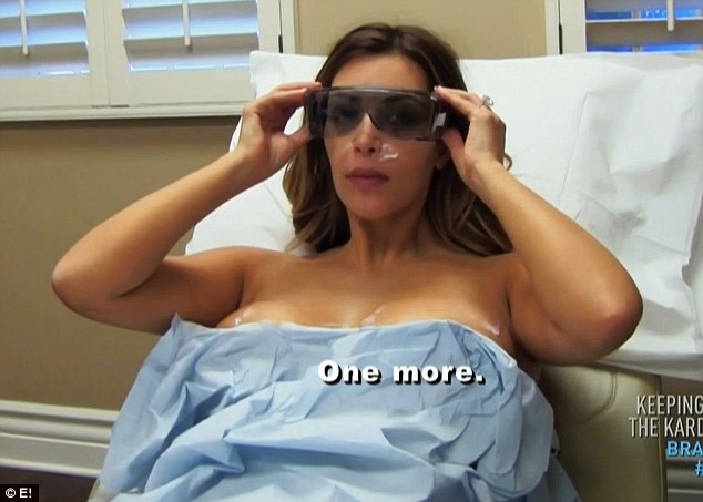 Kim Kardashian Removes Stretch Marks From Her Breasts With Laser  