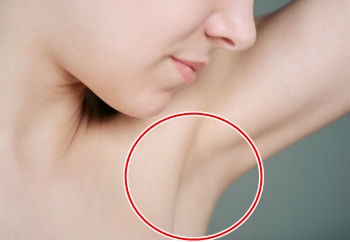 How To EASILY Lighten Dark Underarms Using These Common Kitchen Ingredients
