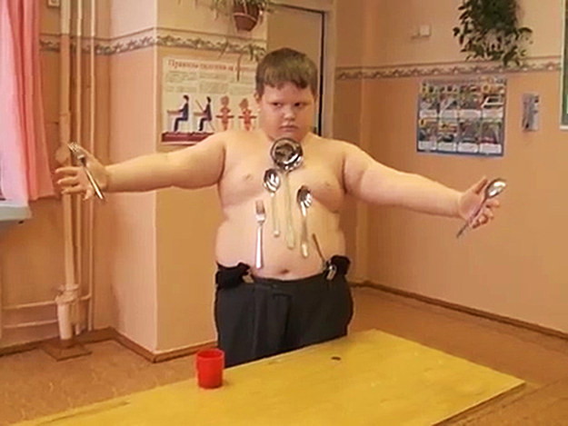 Boy Shocked By Electricity Says He Has Superpowers Like Magneto