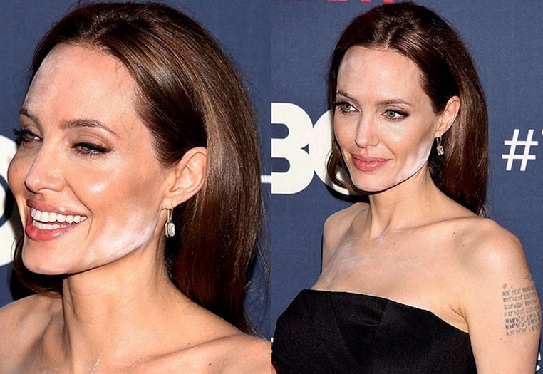 Celebrities Who Had The Most Embarrassing Moments Ever