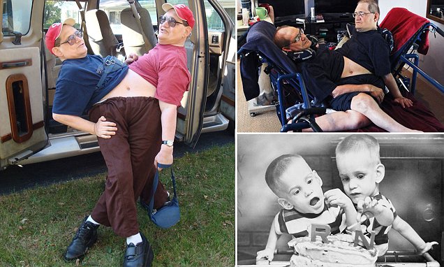 The World s Oldest living Conjoined Twins Celebrate Their 63rd Birthday At Disney World