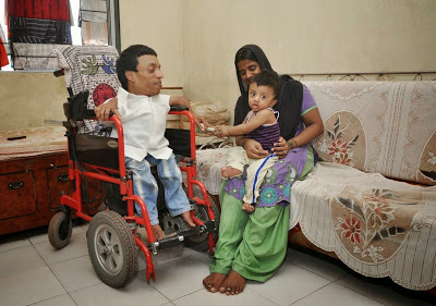 100 cm dwarfed man married with a kid