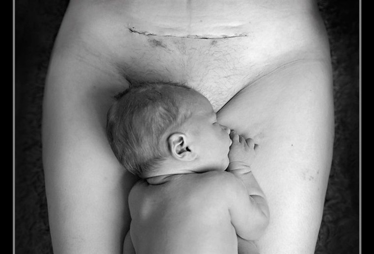 More than 11.5 million people have seen this beautiful c-section scar photo