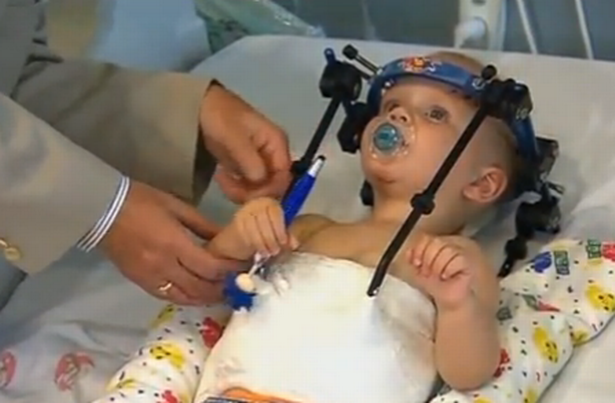 Doctors Reattach Toddlers HEAD After horrible Car Crash