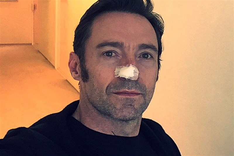 Hugh Jackman’s Cancer Has Returned For The Sixth Time