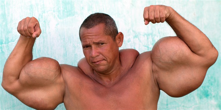 Brazilian Bodybuilder Admits His 29-Inch Biceps Are Fake