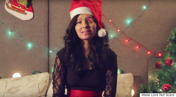 Acid Attack Survivor Reshma Has One Very Important Wish This Christmas