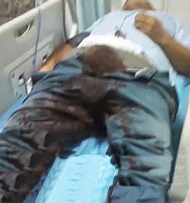 Man Cuts Of His Own Penis Because Girlfriend Says He Was not Good Enough In Bed
