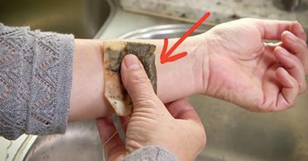 What Happens When You Place A Tea Bag On Your Skin