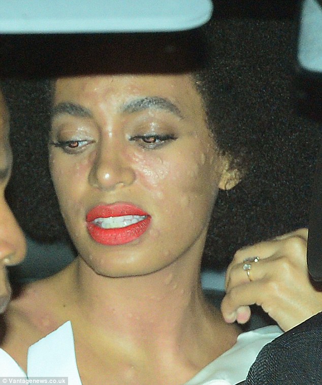 Solange Knowles Breaks Out In Angry Red Hives On Wedding Day as Big Sister Beyonce Tries To Cover Her Up