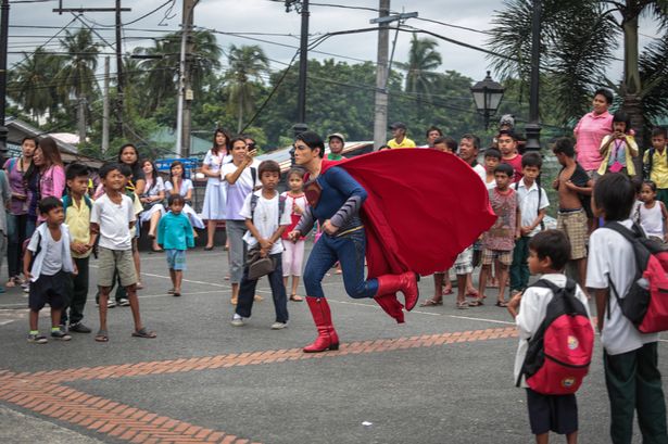 Filipino guy  underwent 23 surgeries to look like superman