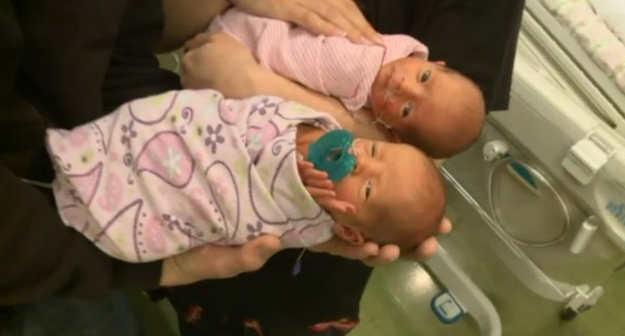 A Woman Gave Birth To A Rare Set Of Mono Mono Twins Without Even Knowing She Was Pregnant