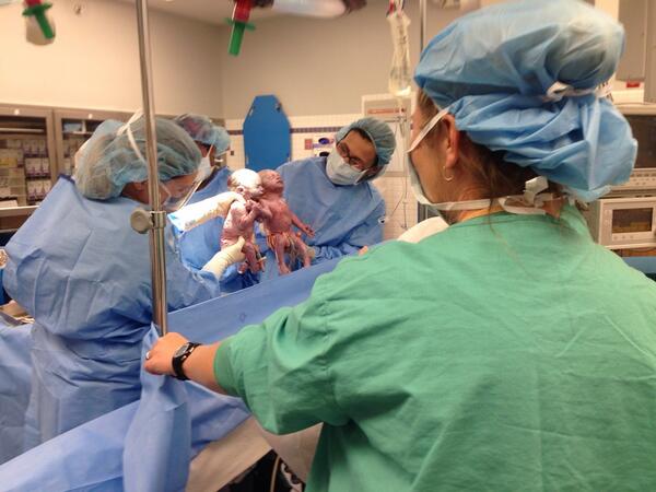 Babies Born Holding Hands Are Still Inseparable Six Months Later