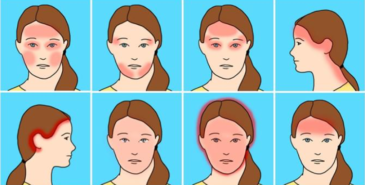 10 Common Headache Types And Their Surprising Causes