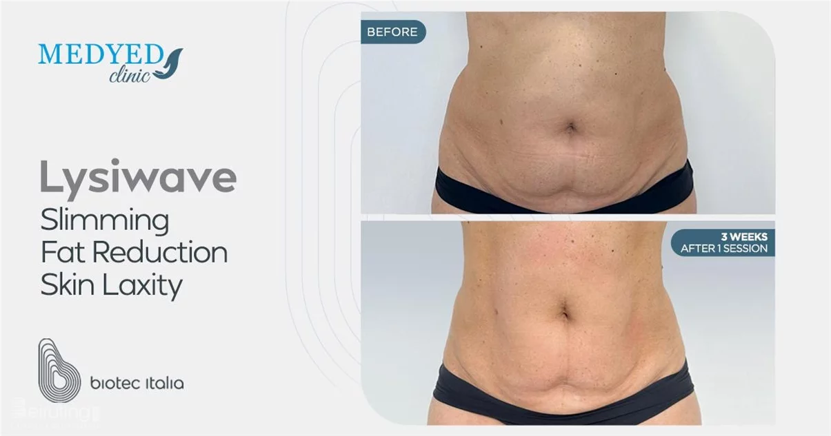 Medyed Clinic: Your One-Stop Destination for Advanced Aesthetic and Wellness Treatments